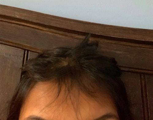 Customer photo review of Growth & Shine Hair Oil