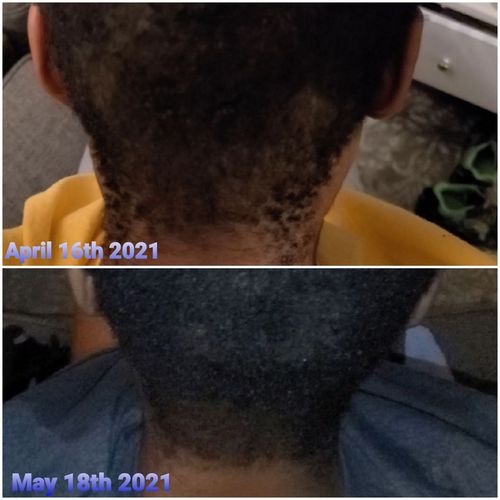 Customer photo review of India’s Secret Ancient Ayurvedic Hair Follicle Elixir (3 sizes)