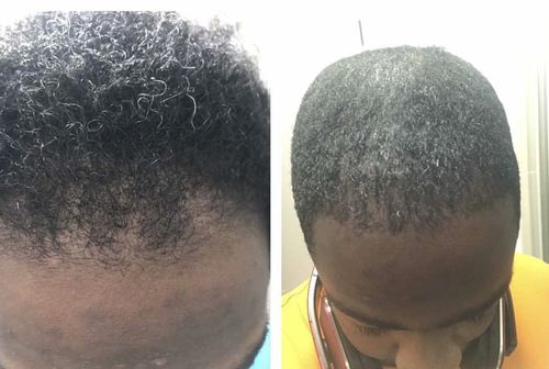 Customer photo review of Inches - Hair & Beard Oil
