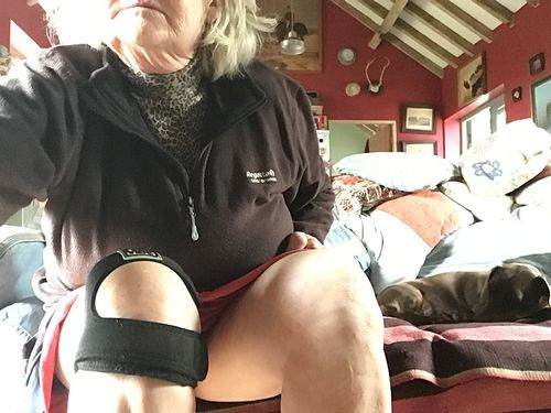Customer photo review of PositVibe Patella Stabilizer