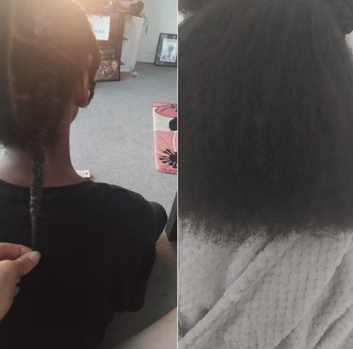 Customer photo review of Roots - Scalp & Beard Oil Treatment