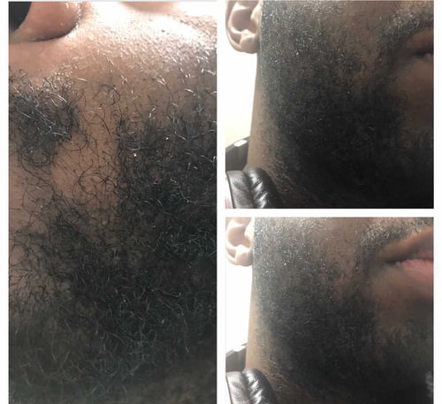 Customer photo review of Inches - Hair & Beard Oil