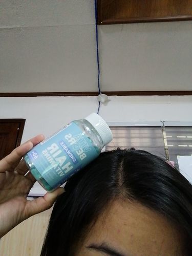Customer photo review of Hair Vitamin Gummies