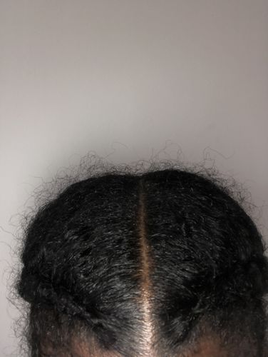 Customer photo review of Roots - Scalp & Beard Oil Treatment