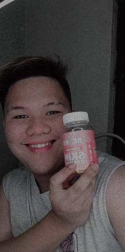Customer photo review of Skin Vitamin Gummies