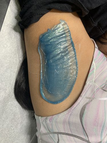 Customer photo review of Pro Series Hair Removal Wax