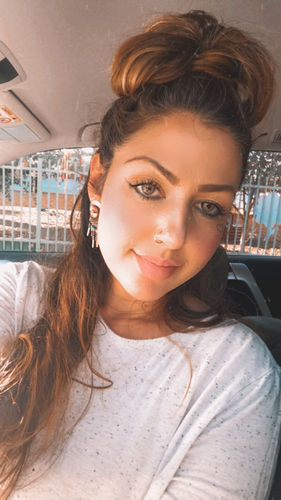 Customer photo review of Citha Hazel Contact Lenses(12 months wear)