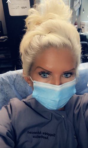 Customer photo review of Topaz Prescription Contact Lenses