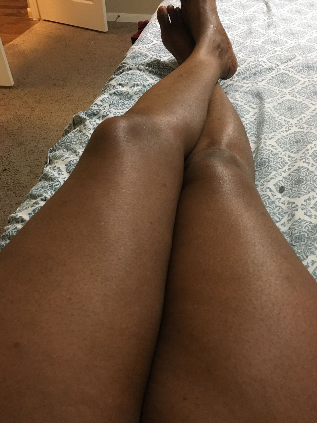 Customer photo review of Fair and White Exclusive Whitenizer Serum with Pure Vitamin "C" 30 ml / 1 fl oz