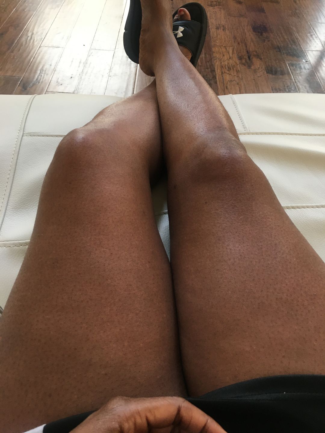 Customer photo review of Fair & White Exclusive Exfoliating Soap with Pure Vitamin C 7 oz / 200 gr