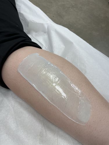 Customer photo review of Signature Series Hair Removal Wax