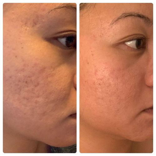 Customer photo review of Niacid