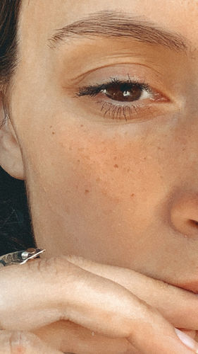 Customer photo review of Freckle Stain