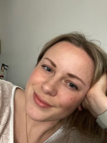 Customer photo review of Freckle Stain