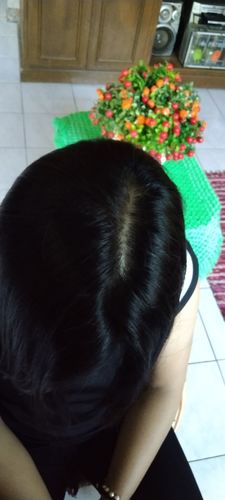 Customer photo review of Hair Vitamin Gummies