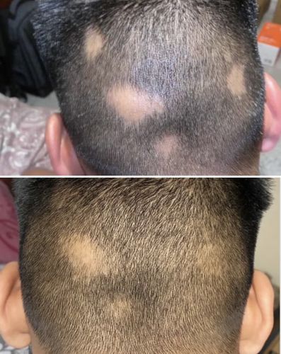 Customer photo review of Inches - Hair & Beard Oil