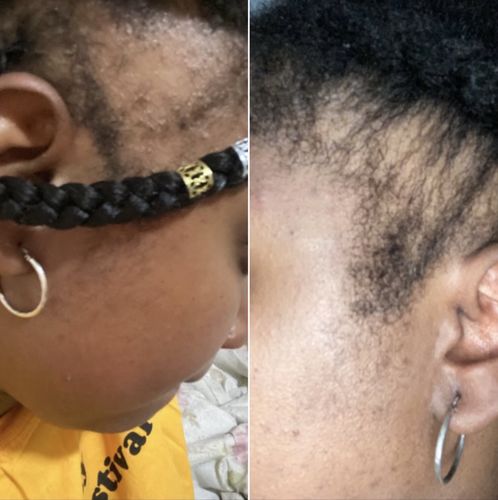 Customer photo review of Inches - Hair & Beard Oil