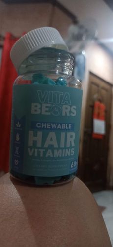 Customer photo review of Hair Vitamin Gummies