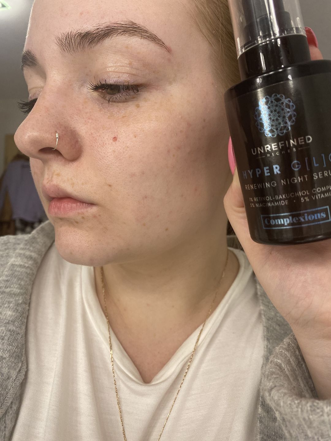 Customer photo review of HYPER G[L]O - Renewing Night Serum