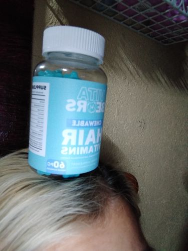 Customer photo review of Hair Vitamin Gummies