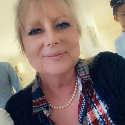 Customer photo review of Sarahbio - huile de pépins de figue de barbarie - 30 mL