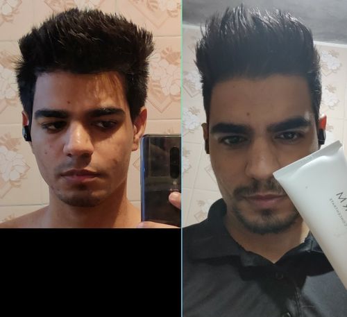 Customer photo review of Serum Concentrate Kit