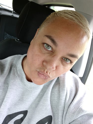 Customer photo review of Citha Hazel Contact Lenses(12 months wear)