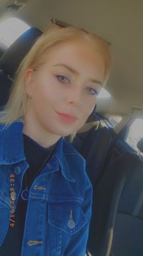 Customer photo review of Cherry Ocean Prescription Contact Lenses