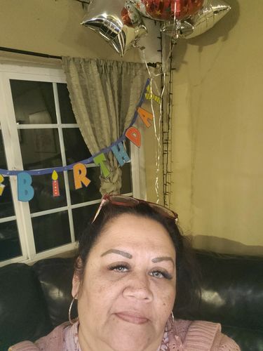 Customer photo review of Citha Hazel Contact Lenses(12 months wear)