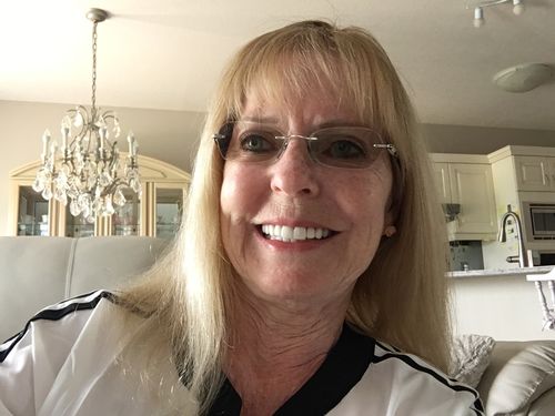 Customer photo review of Full Shine Human Hair Wig Toppers 13cm*13cm For Women Hair Loss Balayage #10/613