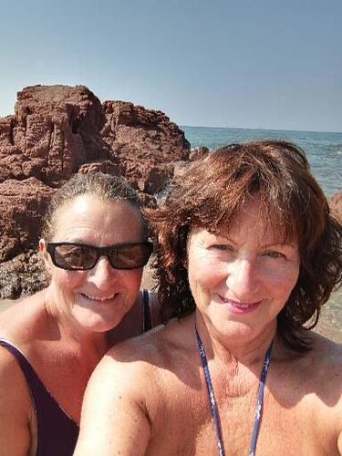 Customer photo review of Acido Ialuronico Puro - Idratante, Rimpolpante, Antirughe, 30ml