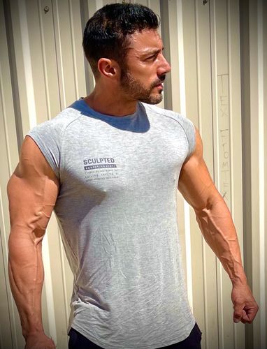 Customer photo review of Capped Sleeve