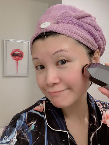 Customer photo review of TriPollar STOP Vx