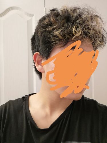 Customer photo review of Serum Concentrate Kit