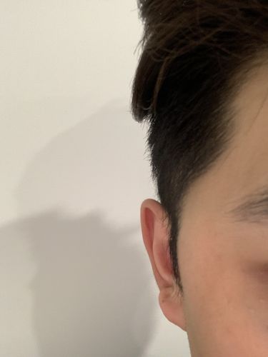 Customer photo review of Serum Concentrate Kit