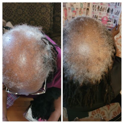 Customer photo review of Nae Nae's Hair Boost 9oz