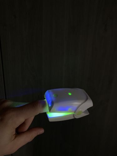 Customer photo review of Dermachom Nail Fungus Treatment