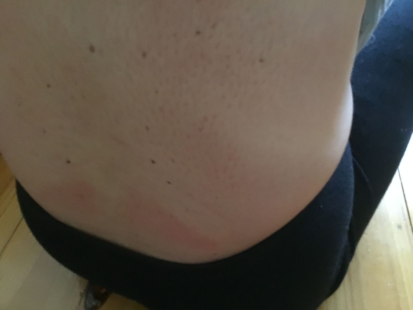 Customer photo review of Acupressure Mat w/ BIO MAGs