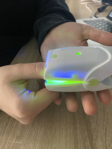 Customer photo review of Dermachom Nail Fungus Treatment