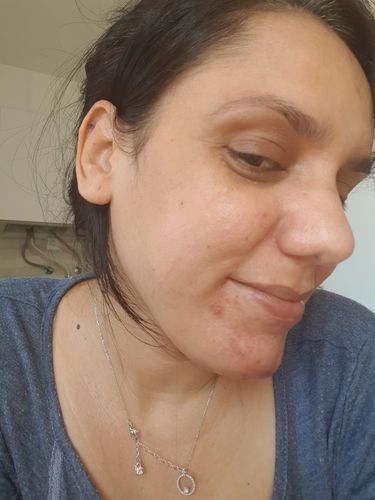 Customer photo review of Decalt