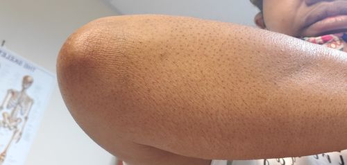 Customer photo review of Nae Nae's 9oz Hair Boost Special