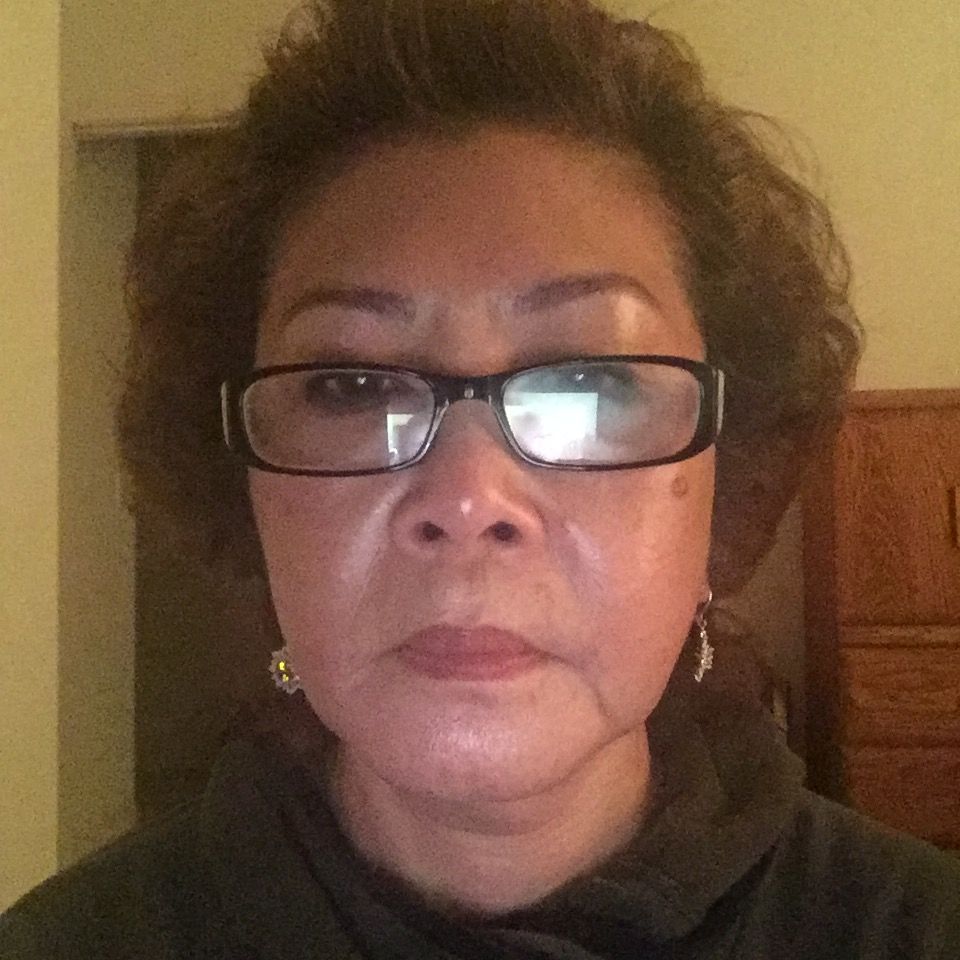 Customer photo review of 10X Cream - Facial Skin Whitening Cream