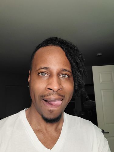 Customer photo review of Neala Brown Contact Lenses(12 months wear)