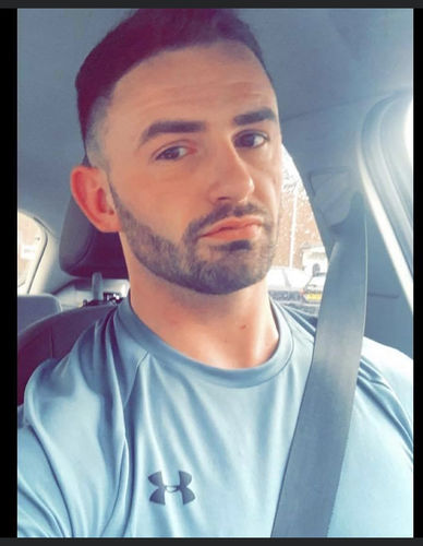 Customer photo review of Teeth Whitening Kit