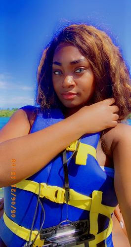 Customer photo review of [US Warehouse] Topaz Prescription Contact Lenses