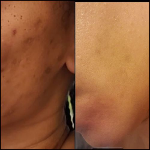 Customer photo review of FILTER FREE TONING SERUM