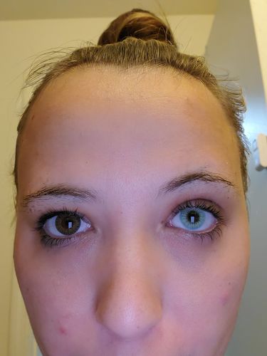 Customer photo review of Topaz Prescription Colored Contact Lenses