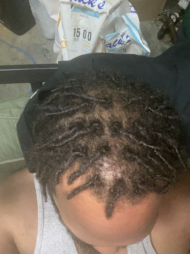 Customer photo review of Hair Growth Serum