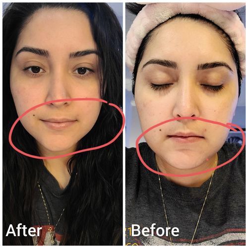 Customer photo review of SELF REFLECTION KIT