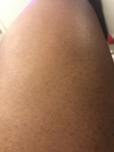 Customer photo review of Fair and White So White Skin Perfector Body Lotion 500ml / 16.90 fl oz